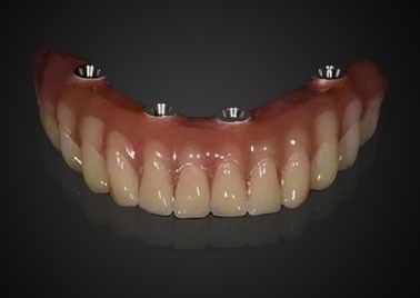 شراء تخصيص استبدال زرع الأسنان التاج مقاوم للاستخدام الطويل الأجل التصنيع عبر الإنترنت