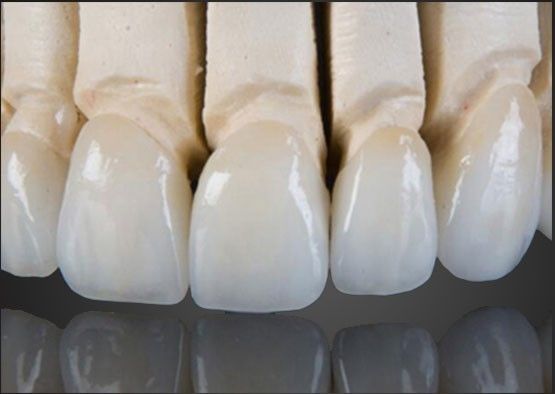 شراء Wieland Zirconia كل التاج السيراميكي الطلاء الداخلي مخصص مع تصميم CAD التصنيع عبر الإنترنت