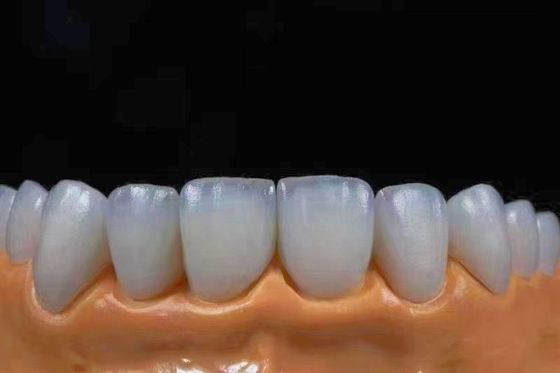شراء التاج الزركونيا الشفاف للغاية مناسبة بدقة مع المظهر الطبيعي التصنيع عبر الإنترنت