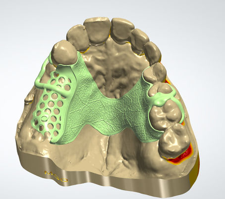 شراء الإطار المعدني الرقمي CAD CAM تصميم الأسنان التصنيع عبر الإنترنت