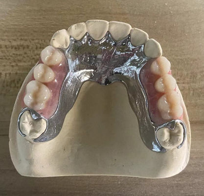 صب الصلبة العالية المعدن الجزئي العدد السنوي Cocr Aolly مع الطباعة 3D
