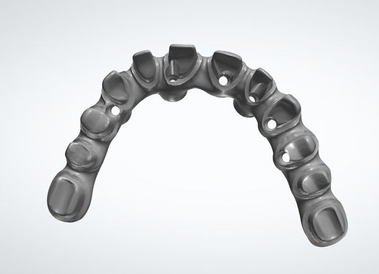 مختبر الأسنان التاج الأسنان أنظمة CAD CAM قابلة للتخصيص لاستعادة الأسنان