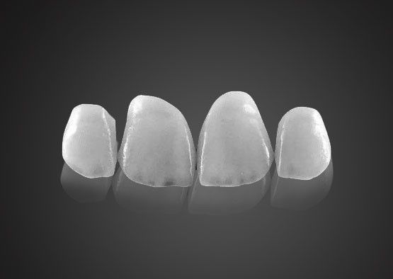IPS 0.2mm القشرة Emax رقيقة للغاية مقاومة للبقع مع قوة عالية