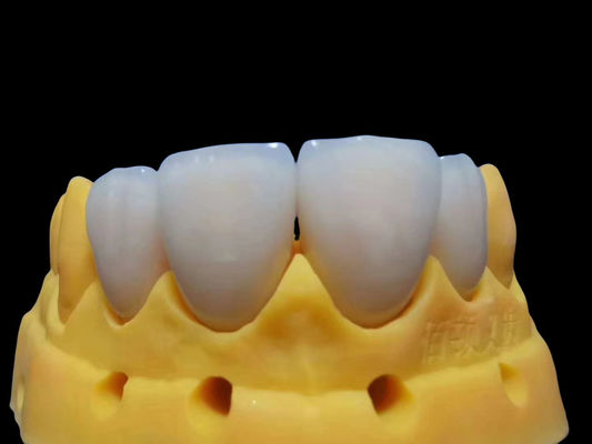 المقاومة للدموع مناسبة كاملة التاج الزركونيا قابلة للتخصيص آمنة للاستخدام