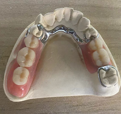 معتمدة الفضة المعدن الإطار الأسنان العضلية مقاومة للتآكل مع تصميم قابلة للتخصيص