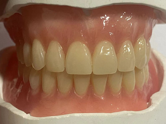 أسنان أكريليك قابلة للتخصيص كاملة الأسنان الاستقرار العالي للاستخدام في طب الأسنان