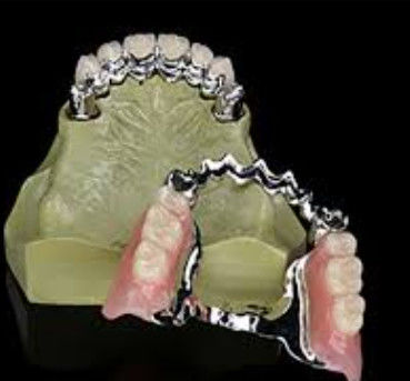 استخدام طويل الأجل المخصصة المفتاح و أسنان المفتاح مع قوة عالية